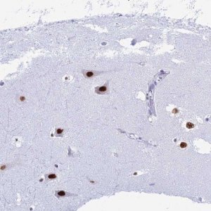 Anti-RNPS1 antibody produced in rabbit 