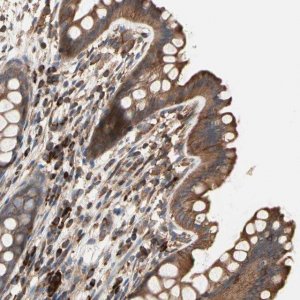 Anti-ROCK1 antibody produced in rabbit 