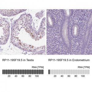 Anti-RP11-195F19.5 antibody produced in rabbit 