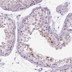 Anti-RP11-195F19.5 antibody produced in rabbit 