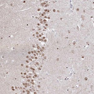 Anti-RP11-382A20.3 antibody produced in rabbit 