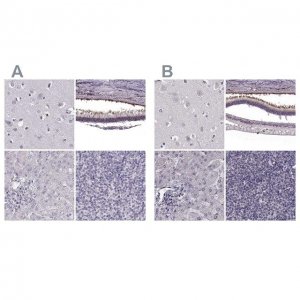 Anti-RP1L1 antibody produced in rabbit 