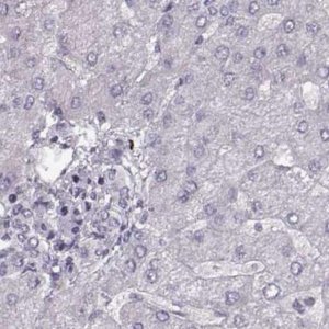 Anti-RP1L1 antibody produced in rabbit 