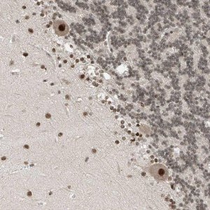 Anti-RPAIN antibody produced in rabbit 