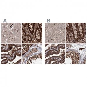 Anti-RPAP3 antibody produced in rabbit 