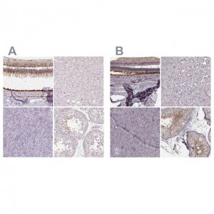 Anti-RPGRIP1 antibody produced in rabbit 