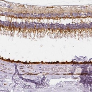 Anti-RPGRIP1 antibody produced in rabbit 