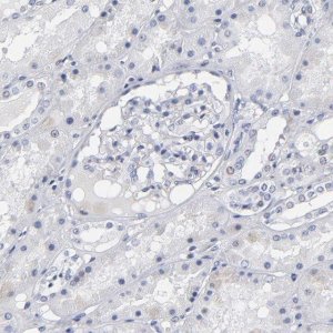 Anti-RPH3A antibody produced in rabbit 