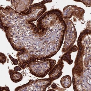 Anti-RPIA antibody produced in rabbit 