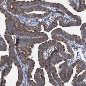 Anti-RPL10 antibody produced in rabbit HPA011311-100UL