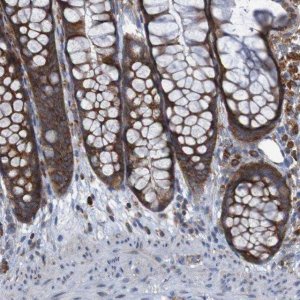 Anti-RPL10 antibody produced in rabbit HPA011311-100UL