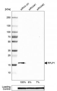 Anti-RPLP1 antibody produced in rabbit 