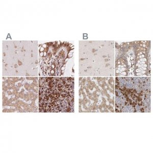 Anti-RPN1 antibody produced in rabbit HPA051520-100UL