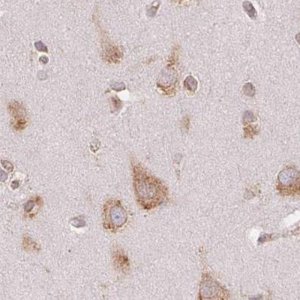 Anti-RPN1 antibody produced in rabbit HPA051520-100UL