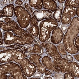Anti-RPP14 antibody produced in rabbit 