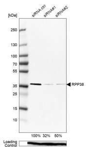 Anti-RPP38 antibody produced in rabbit 