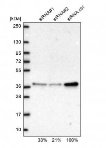 Anti-RPP38 antibody produced in rabbit 