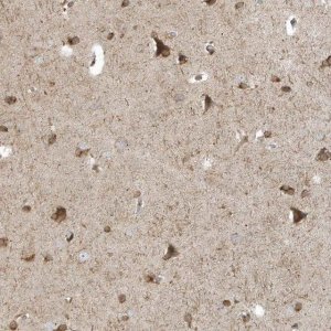 Anti-RPP40 antibody produced in rabbit 