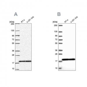 Anti-RPS15 antibody produced in rabbit 