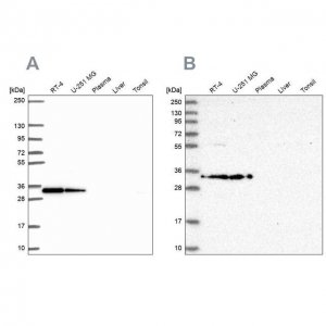 Anti-RPS3A antibody produced in rabbit HPA053454-100UL