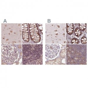Anti-RPS5 antibody produced in rabbit HPA061979-100UL