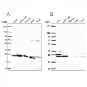Anti-RPS5 antibody produced in rabbit HPA061979-100UL