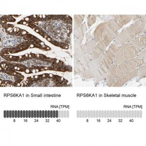 Anti-RPS6KA1 antibody produced in rabbit HPA007981-100UL