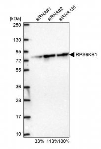 Anti-RPS6KB1 antibody produced in rabbit HPA039442-100UL