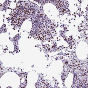 Anti-RPS6KB1 antibody produced in rabbit HPA039442-100UL