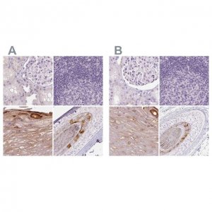 Anti-RPTN antibody produced in rabbit 