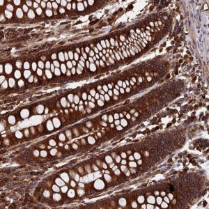 Anti-RPUSD1 antibody produced in rabbit 
