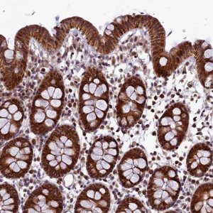 Anti-RPUSD2 antibody produced in rabbit 