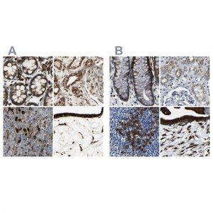 Anti-RRBP1 antibody produced in rabbit 