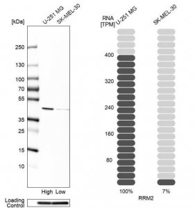Anti-RRM2 antibody produced in rabbit 