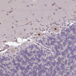 Anti-RRN3 antibody produced in rabbit 