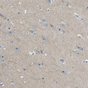 Anti-RRP1 antibody produced in rabbit 