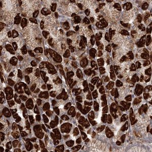 Anti-RRP36 antibody produced in rabbit 