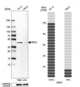 Anti-RRS1 antibody produced in rabbit HPA060937-100UL