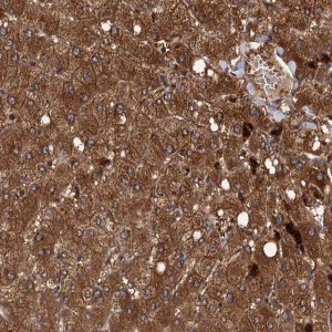 Anti-RSAD2 antibody produced in rabbit 