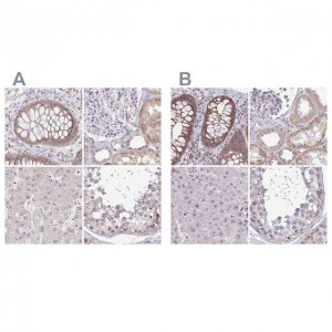 Anti-RSL24D1 antibody produced in rabbit 