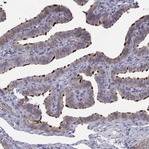 Anti-RSPH14 antibody produced in rabbit 
