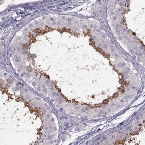 Anti-RSPH6A antibody produced in rabbit 