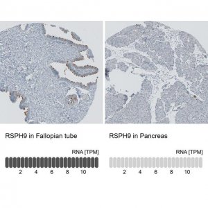 Anti-RSPH9 antibody produced in rabbit 
