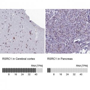 Anti-RSRC1 antibody produced in rabbit 