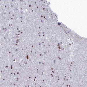 Anti-RSRC1 antibody produced in rabbit 