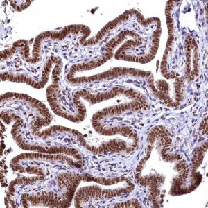 Anti-RSRC2 antibody produced in rabbit 