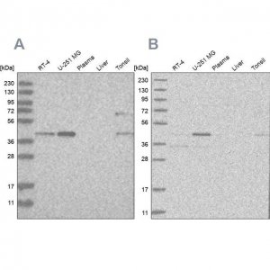 Anti-RTCA antibody produced in rabbit HPA027982-100UL