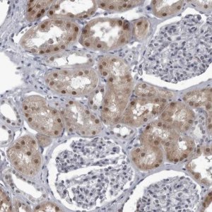 Anti-RTCA antibody produced in rabbit HPA027982-100UL