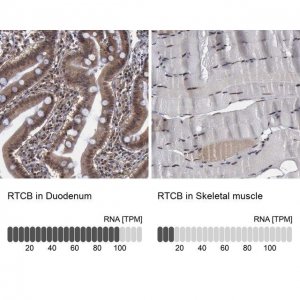 Anti-RTCB antibody produced in rabbit 