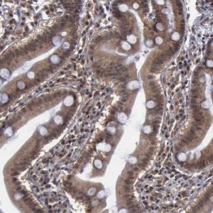 Anti-RTCB antibody produced in rabbit 